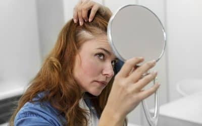 Anemia caída de pelo : por qué se produce, síntomas y soluciones tratamientos