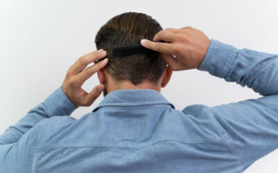 ¿Cómo se elige la densidad en un injerto capilar o de barba?