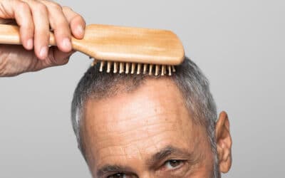 Caída difusa del cabello: causas médicas más frecuentes