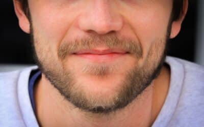 Injerto de barba densidad y diseño personalizado