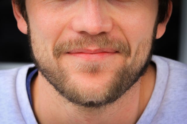 Injerto de barba densidad y diseño personalizado