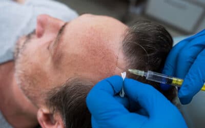 Mesoterapia con biotina beneficios reales cabello