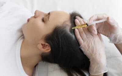 Mesoterapia capilar resultados, ¿cuánto tarda en verse?